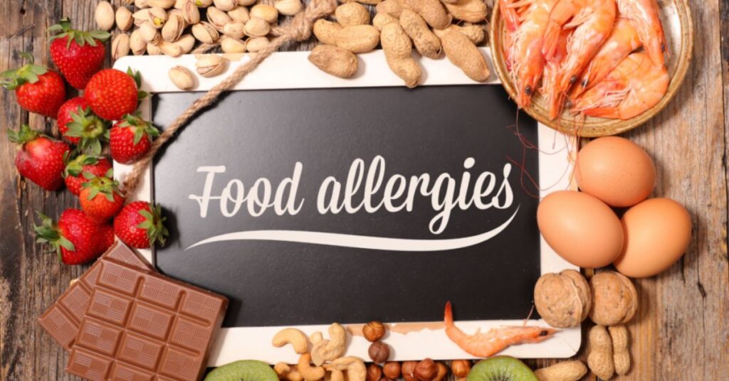 Food Allergies